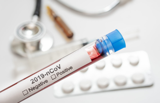 Pesquisa da UFC conclui que medicamentos do coquetel anti-HIV não têm eficácia no tratamento da covid-19