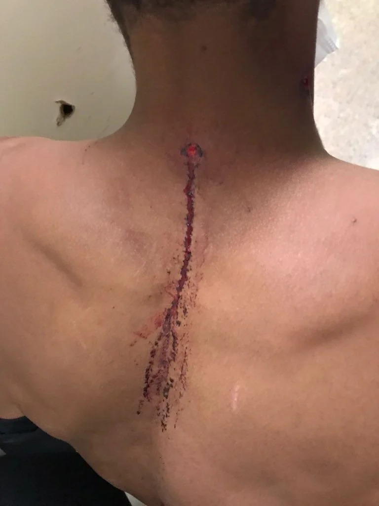 Homem sobrevive após ser baleado no pescoço