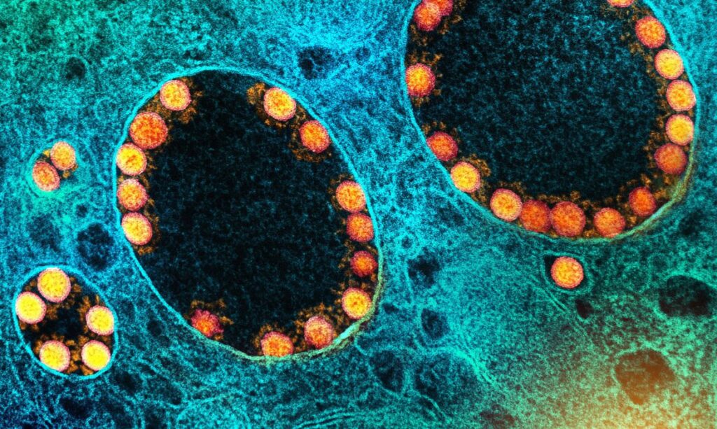 Primeira morte pela nova variante Ômicron no mundo é confirmada no Reino Unido