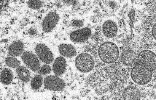 Brasil já tem mais de 200 casos confirmados de varíola dos macacos