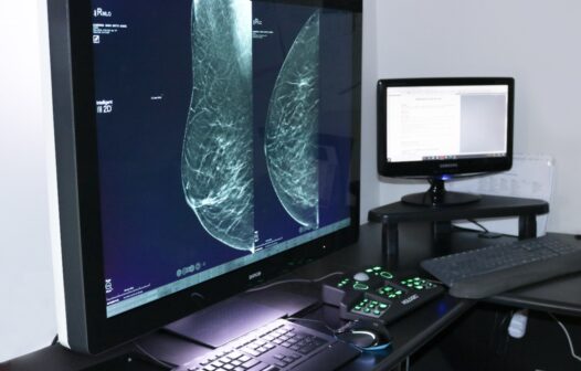 Comissão Nacional de Mamografia recomenda a tomossíntese como principal exame de rastreio para o câncer de mama
