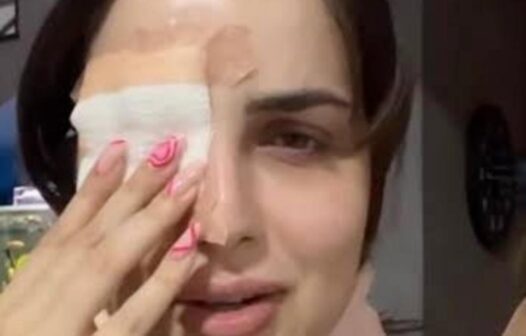 Youtuber é internada em hospital após coçar olho