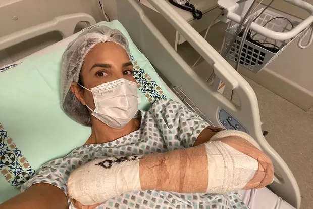 Ivete Sangalo passa por cirurgia no braço esquerdo: “mainha tá zero bala”