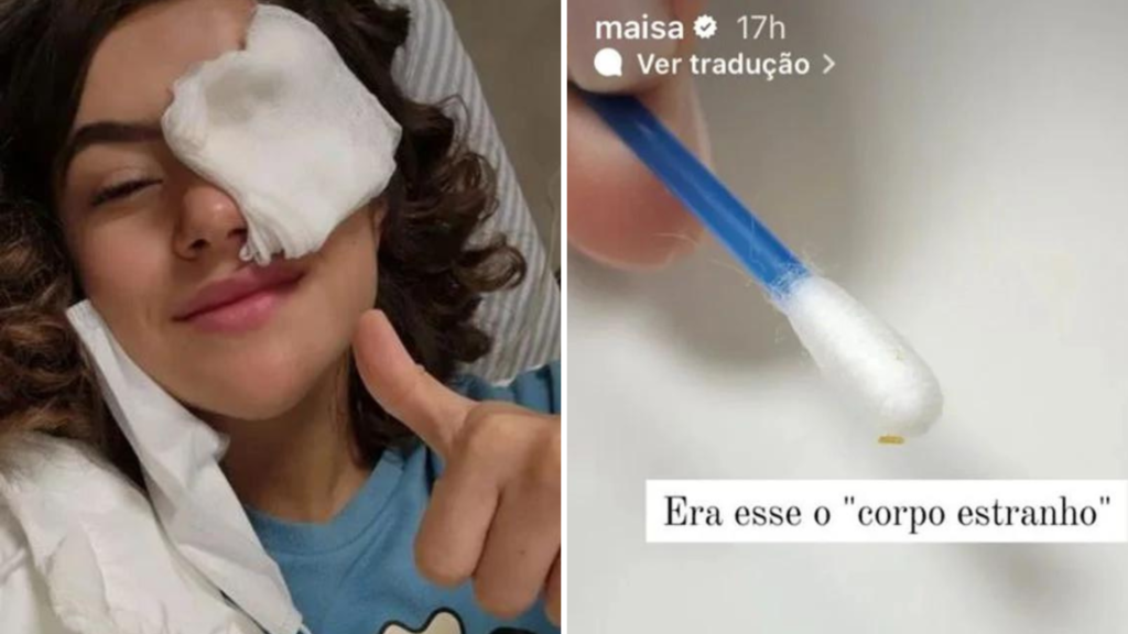 Maisa vai parar no hospital depois de cisco cair no olho