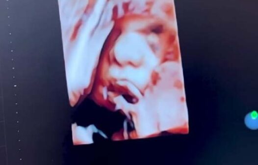 Virgínia Fonseca mostra foto de caçula em ultrassom 3D