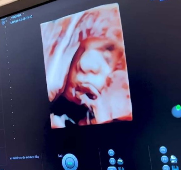 Virgínia Fonseca mostra foto de caçula em ultrassom 3D