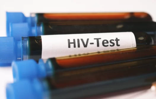 Entenda a diferença entre HIV e AIDS