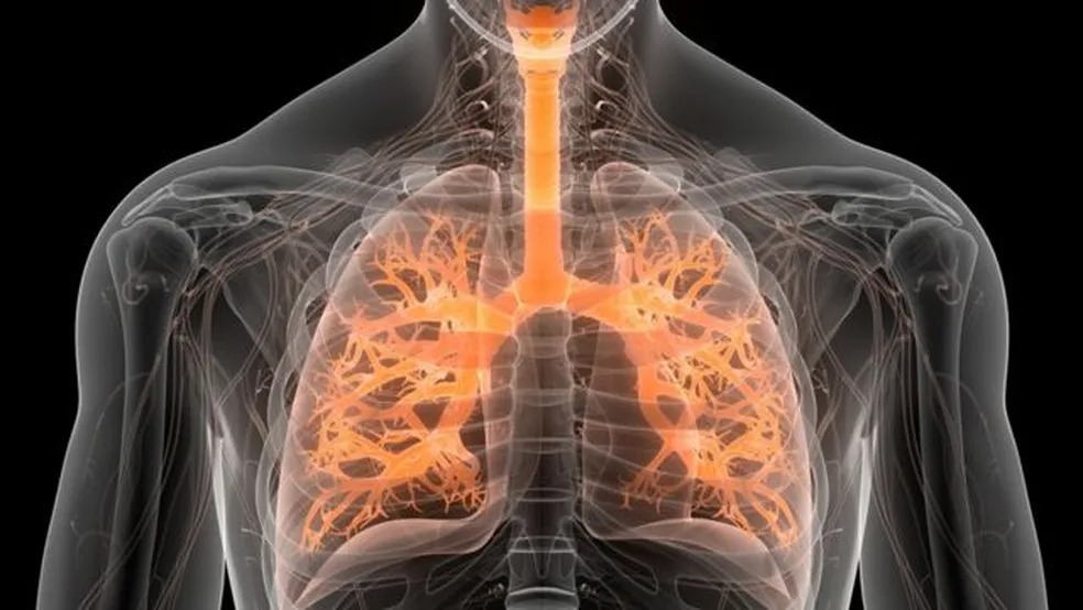 Pneumologista detalha sintomas e tratamento da fibrose pulmonar, causa da morte da cantora cearense Rita de Cássia