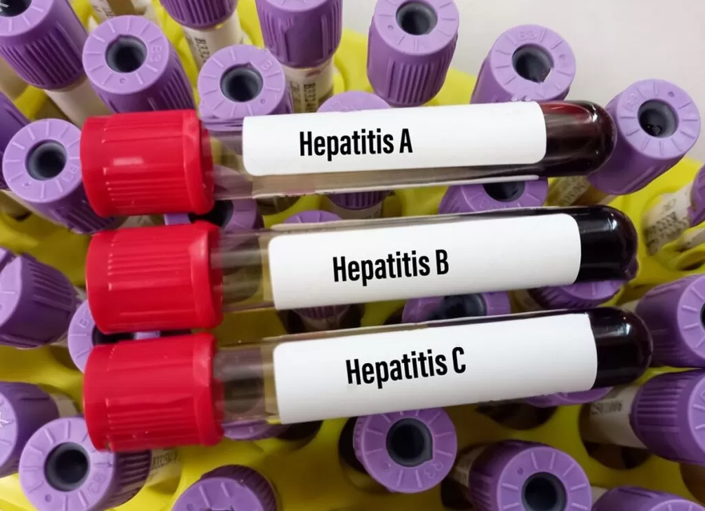 Diagnósticos de hepatites virais aumentaram depois da pandemia no Brasil, aponta pesquisa