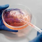Bactéria provoca casos graves de infecção no Japão
