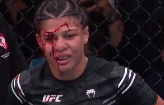 Brasileira Mayra Sheetara sofre corte grotesco e perde luta no UFC 303