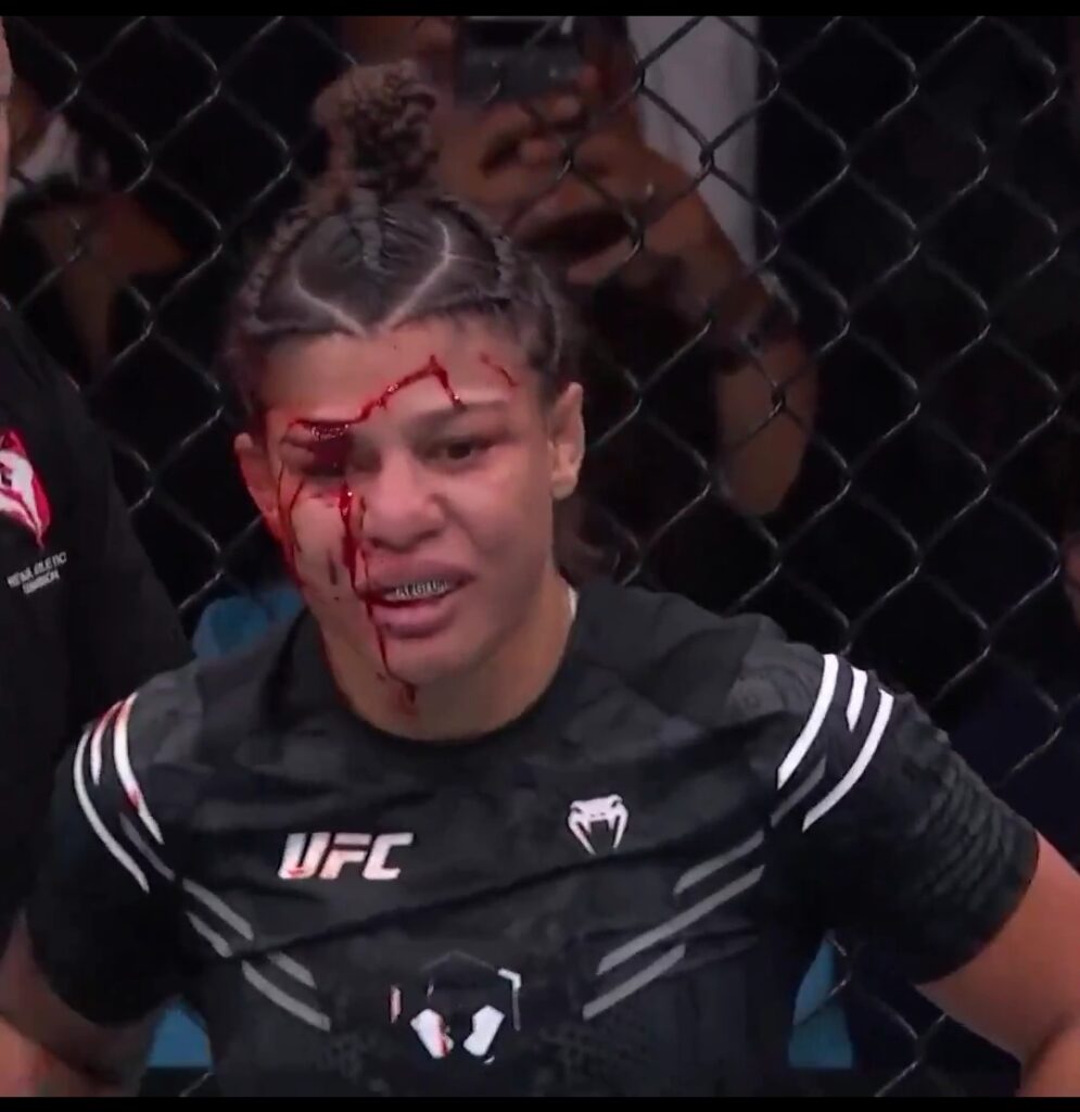 Brasileira Mayra Sheetara sofre corte grotesco e perde luta no UFC 303