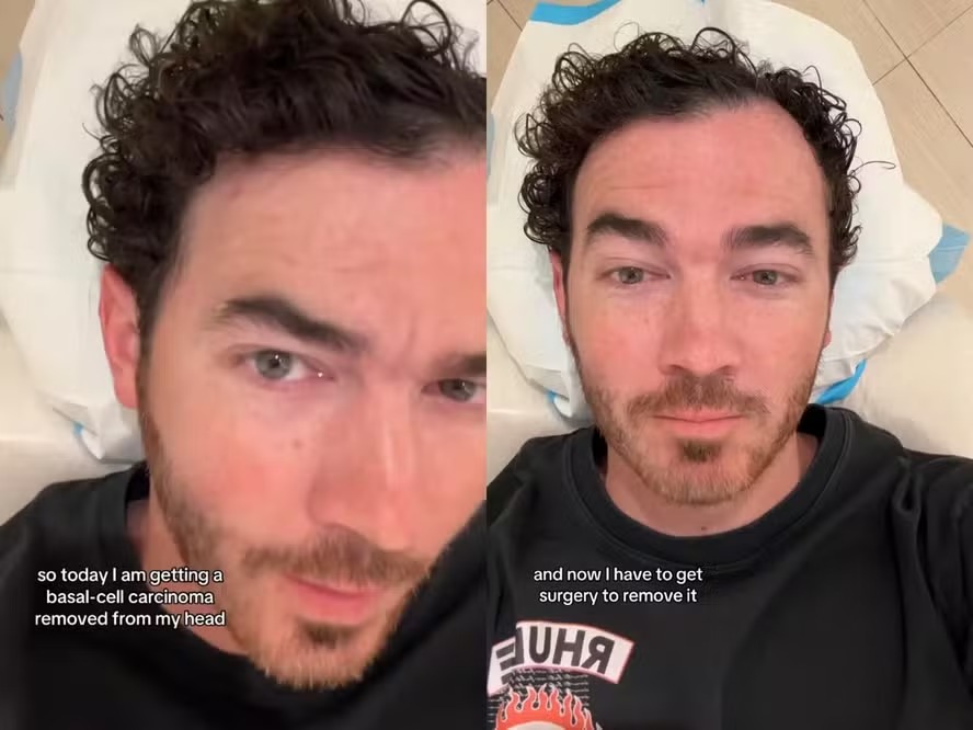 Kevin Jonas revela procedimento cirúrgico para retirada de um câncer de pele