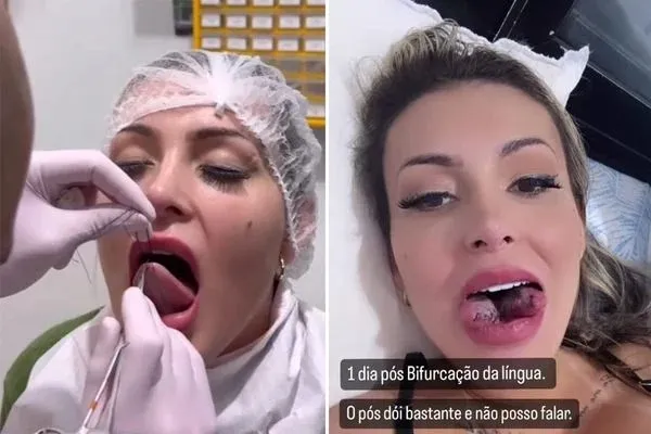 Andressa Urach choca a web ao aparecer com a língua bifurcada