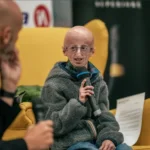 Progeria, a doença do envelhecimento precoce, tem cura? Conheça o quadro