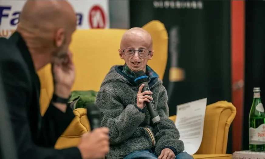 Progeria, a doença do envelhecimento precoce, tem cura? Conheça o quadro