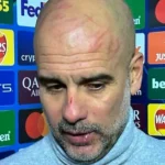 Guardiola aparece com arranhões no rosto e esclarece comentários sobre automutilação