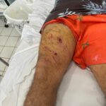 Idoso de 67 anos é mordido por jacaré em lagoa na Grande Fortaleza