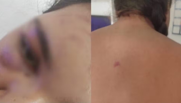 Mulher é agredida por ex-namorado e familiares após se recusar a manter relação sexual no interior do Ceará