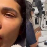 Pocah fere o olho em acidente e cancela show