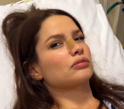 Juliette fratura o nariz ao bater em porta de vidro dentro de casa