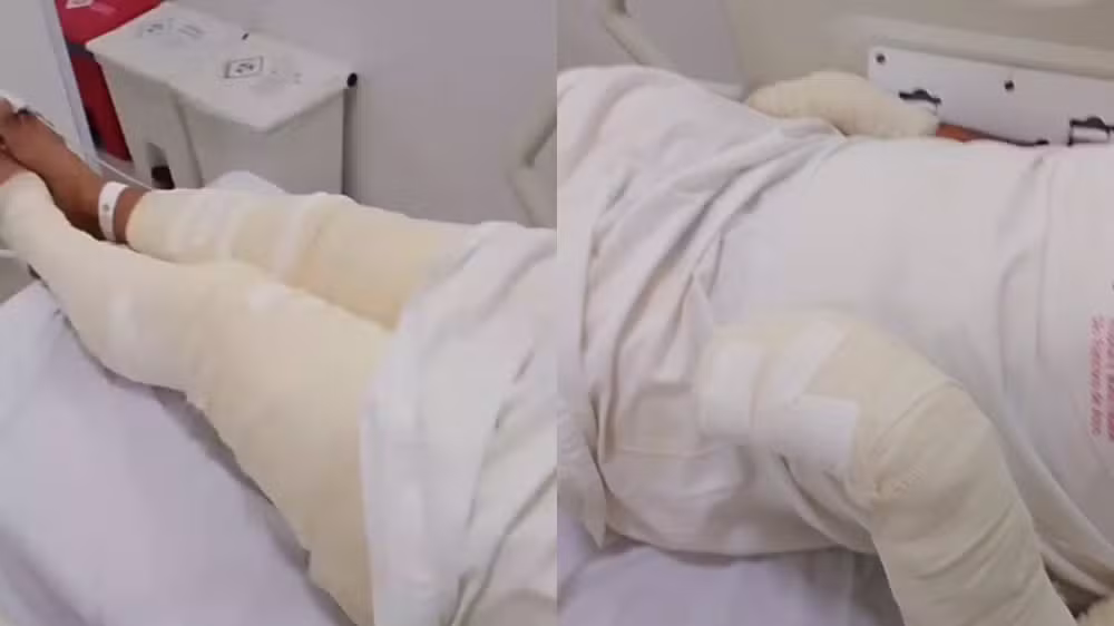 Homem é preso no Ceará após tentar matar irmão queimado enquanto ele dormia