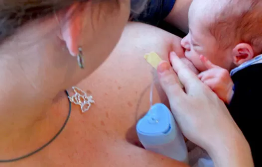 Amamentação reduz risco para câncer de mama
