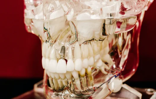 Covid amolece os dentes?