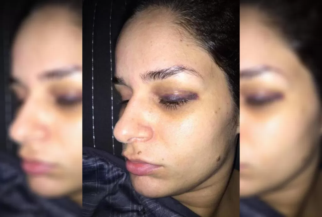 DJ Ivis é acusado de agredir esposa; veja imagens