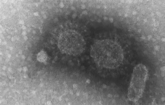 Maioria das doenças infecciosas tem origem em animais selvagens