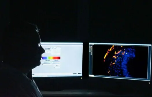 Estudo busca identificar tratamento gênico para Síndrome de Pitt-Hopki