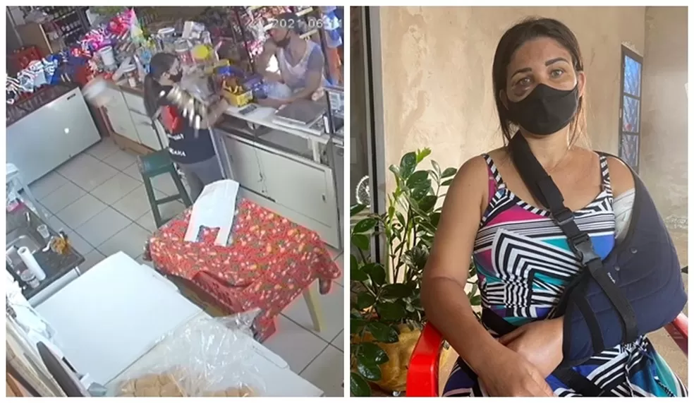 Funcionária de padaria é agredida e tem o braço quebrado após pedir que cliente colocasse máscara