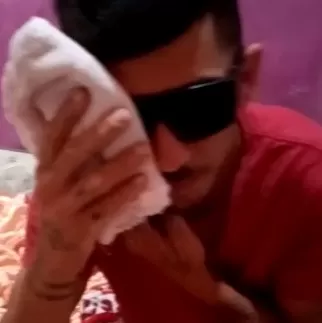Jovem de Pedra Branca afirma que já não consegue enxergar em um dos olhos após celular explodir