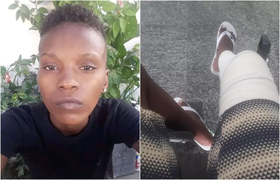LGBTfobia: mulher é agredida e tem joelho quebrado ao tentar usar banheiro em Tauá