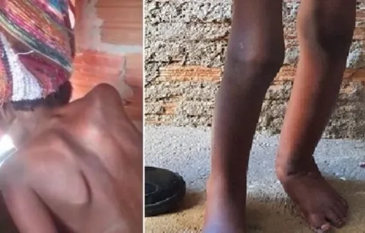 Vizinhos de criança acorrentada em tonel desconfiavam de maus tratos