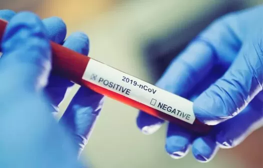 Covid-19: genes do sistema imune podem explicar resistência ao vírus