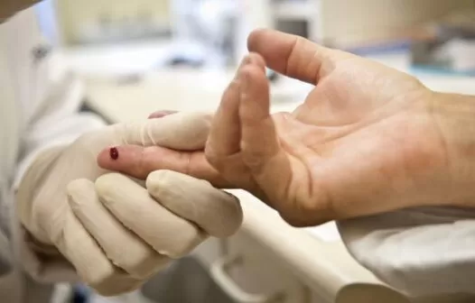 Ceará teve 1.650 casos de HIV e 742 de Aids em 2023