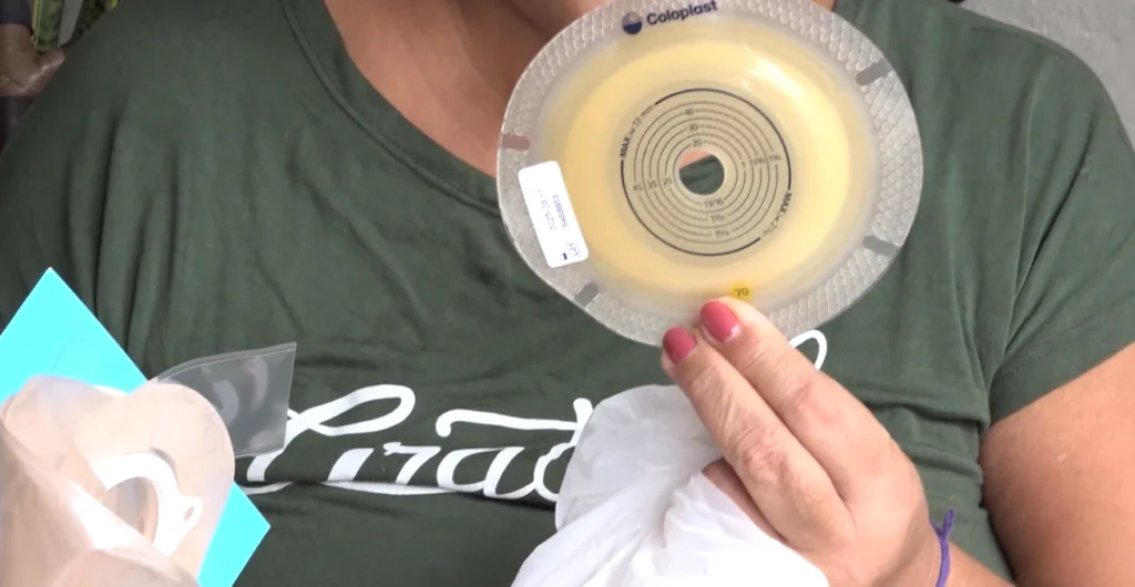 Pacientes ostomizados reclamam da falta de insumos; Sesa nega informação