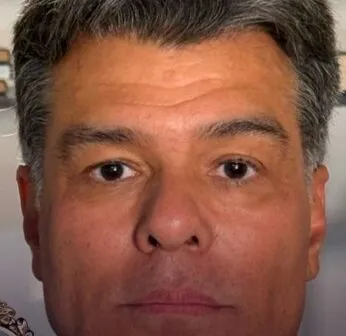 Mauricio Mattar passa por harmonização facial e mostra resultado; compare