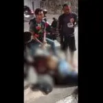 Turista é assaltado e espancado na área nobre de Fortaleza e fica com fratura no maxilar