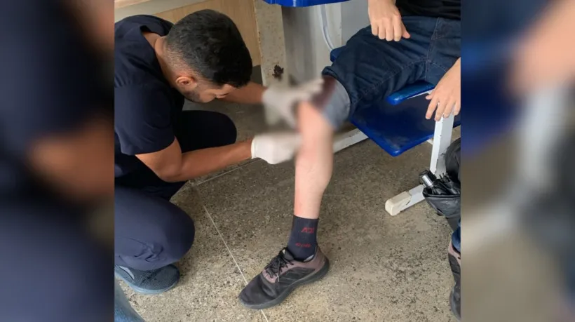 Estudante da UFC é esfaqueado em tentativa de assalto próximo ao campus do Porangabuçu