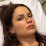 Juliette fratura o nariz ao bater em porta de vidro dentro de casa